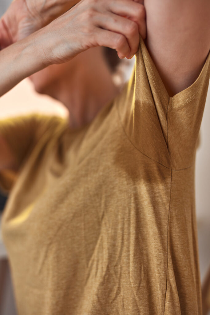 Hyperhidrosis is a condition that causes excessive sweating beyond what the body needs for temperature regulation